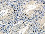 WT1 Antibody in Immunohistochemistry (Paraffin) (IHC (P))