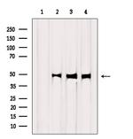 WT1 Antibody in Western Blot (WB)