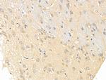 ZNF281 Antibody in Immunohistochemistry (Paraffin) (IHC (P))