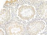 ZNF281 Antibody in Immunohistochemistry (Paraffin) (IHC (P))