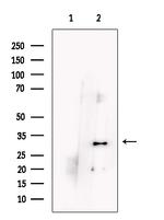 PHOSPHO1 Antibody in Western Blot (WB)