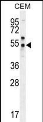 PSMAL Antibody in Western Blot (WB)