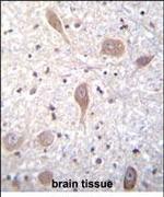 SPON1 Antibody in Immunohistochemistry (Paraffin) (IHC (P))