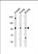 SPON1 Antibody in Western Blot (WB)