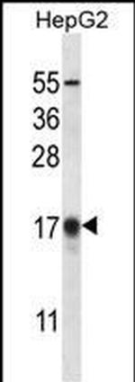 LC3B Antibody in Western Blot (WB)