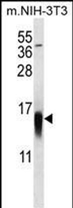 LC3B Antibody in Western Blot (WB)