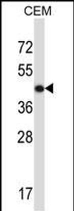 ACTG2 Antibody in Western Blot (WB)