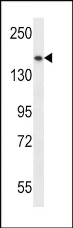 SMC1 Antibody in Western Blot (WB)