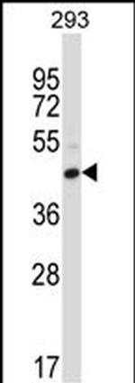 CD32 Antibody in Western Blot (WB)