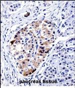 VAMP3 Antibody in Immunohistochemistry (Paraffin) (IHC (P))