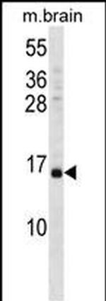 VAMP3 Antibody in Western Blot (WB)