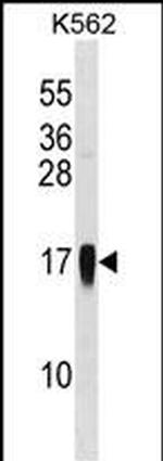 MCP-3 Antibody in Western Blot (WB)