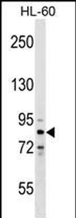 ZNF224 Antibody in Western Blot (WB)