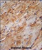 LC3B Antibody in Immunohistochemistry (Paraffin) (IHC (P))