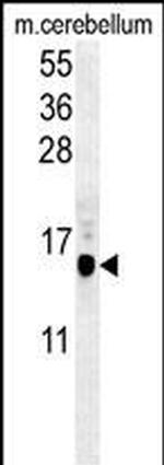 LC3B Antibody in Western Blot (WB)