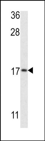 LC3B Antibody in Western Blot (WB)