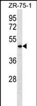 VN1R5 Antibody in Western Blot (WB)