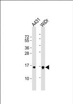 Histone H2B Antibody in Western Blot (WB)