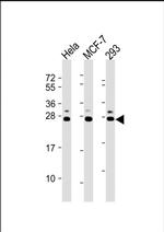 KDEL Antibody in Western Blot (WB)