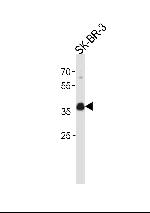 Estrogen Receptor alpha Antibody in Western Blot (WB)