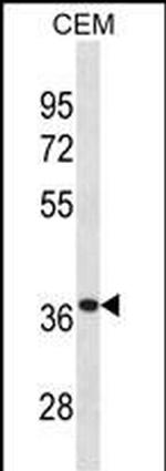 alpha TTP Antibody in Western Blot (WB)