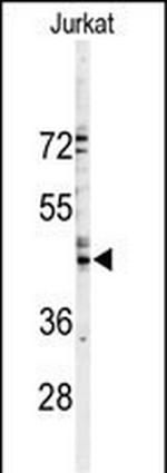 Connexin 46 Antibody in Western Blot (WB)