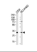 Macro H2A.2 Antibody in Western Blot (WB)