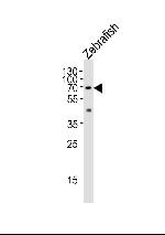 L-Plastin Antibody in Western Blot (WB)