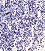 ANAPC2 Antibody in Immunohistochemistry (Paraffin) (IHC (P))