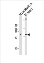 SCXA Antibody in Western Blot (WB)