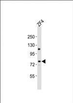 MTM1 Antibody in Western Blot (WB)