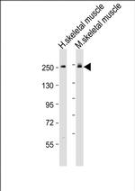 MYH6 Antibody in Western Blot (WB)