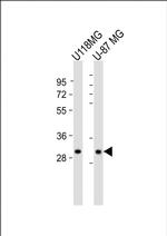 STX1B Antibody in Western Blot (WB)