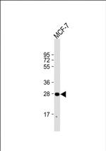 H1FNT Antibody in Western Blot (WB)