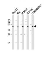 GNAS Antibody in Western Blot (WB)