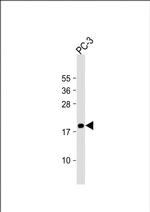 MEAF6 Antibody in Western Blot (WB)