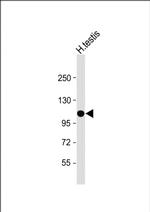 UT-A1 Antibody in Western Blot (WB)