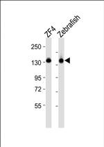 CYFIP1 Antibody in Western Blot (WB)