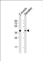 ENG2B Antibody in Western Blot (WB)