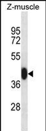 MEF2C Antibody in Western Blot (WB)