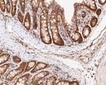 MTAP Antibody in Immunohistochemistry (Paraffin) (IHC (P))