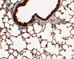 MTAP Antibody in Immunohistochemistry (Paraffin) (IHC (P))