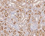 GABRB1 Antibody in Immunohistochemistry (Paraffin) (IHC (P))