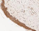 GABRB1 Antibody in Immunohistochemistry (Paraffin) (IHC (P))