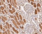 GABRB1 Antibody in Immunohistochemistry (Paraffin) (IHC (P))