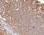 GABRB1 Antibody in Immunohistochemistry (Paraffin) (IHC (P))