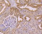 USP21 Antibody in Immunohistochemistry (Paraffin) (IHC (P))