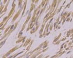 USP21 Antibody in Immunohistochemistry (Paraffin) (IHC (P))