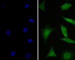 GABARAPL2 Antibody in Immunocytochemistry (ICC/IF)