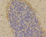 GABARAPL2 Antibody in Immunohistochemistry (Paraffin) (IHC (P))